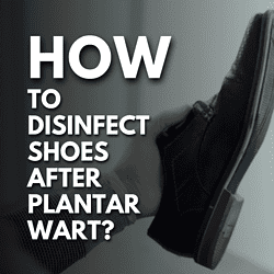 How to Disinfect Shoes After Plantar Wart