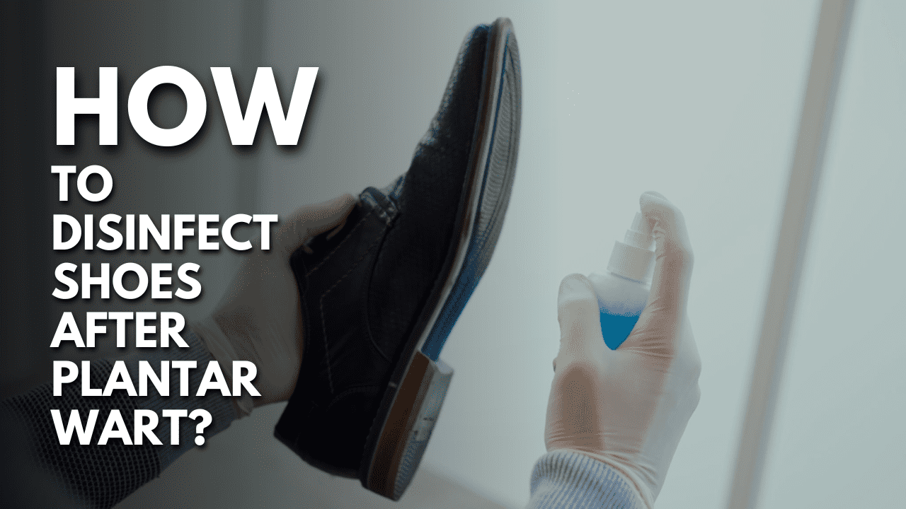 How to Disinfect Shoes After Plantar Wart